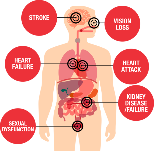 Cardiovascular Disease Symptoms And Treatment An Indepth List